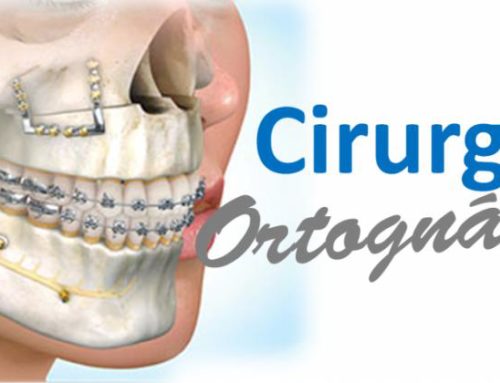 Cirurgia Ortognática: Saiba o que É e COMO ela pode transformar sua VIDA!